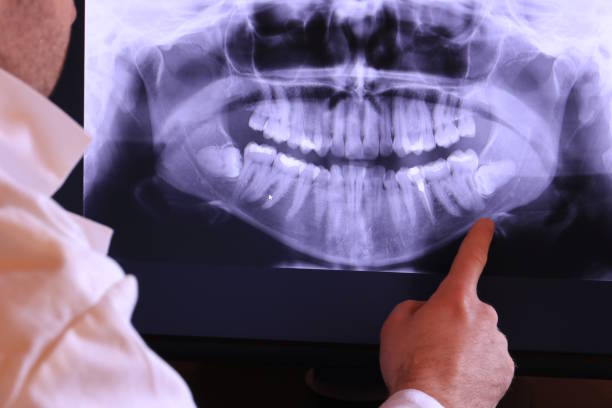 Best Broken or Chipped Tooth Repair in Albuquerque, NM