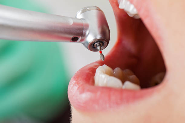 Best Emergency Cosmetic Dentistry (e.g., broken veneers) in Albuquerque, NM